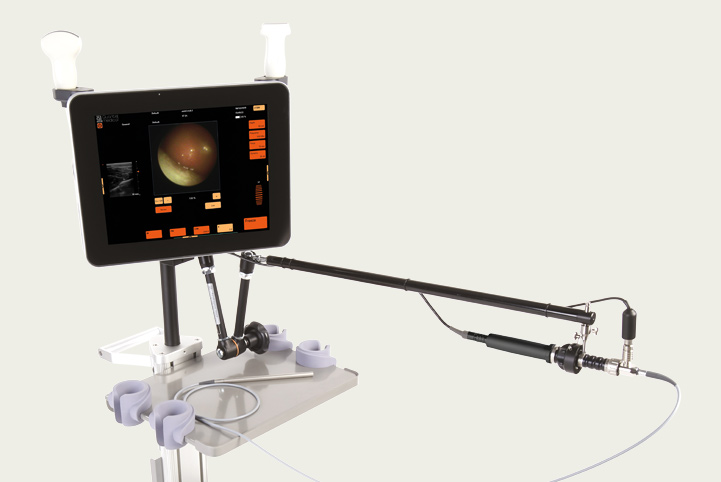 7StarScope es un ecógrafo con micro-endoscopio integrado para intervenciones eco-guiadas precisas