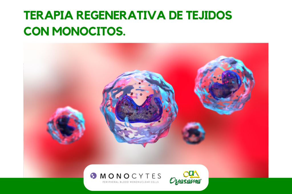 terapia regenerativa con monocitos de oyasama